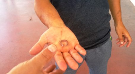 Parmağındaki yüzüğü hastanede itfaiye kurtardı
